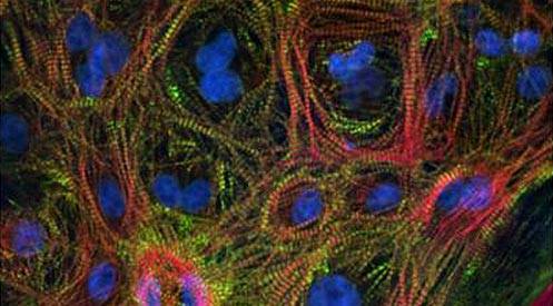 Cardiac Stain